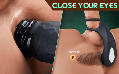 Omareon Upgraded 5- in 1 pleasurable prostate stimulator with cockring